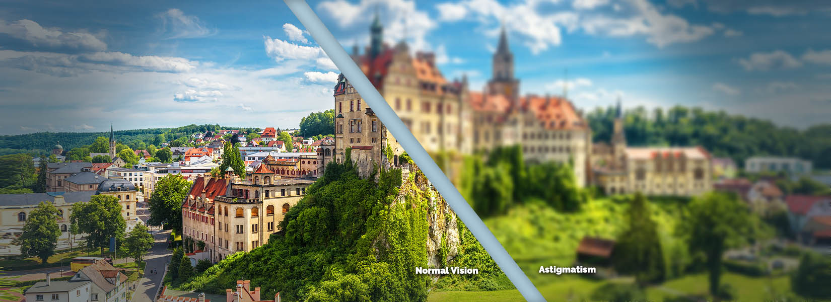Astigmatism Treatment in Plymouth